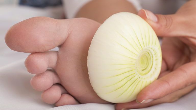 Zwiebelscheiben im Fuß als medizinische Behandlung